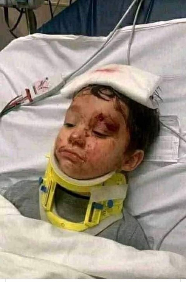 حقيقة وفاة الطفل ريان المغربي سبب وفاة الطفل ريان مات 6