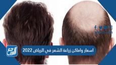 اسعار واماكن زراعة الشعر في الرياض 2022