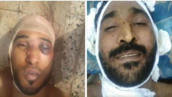 صور مفزعة.. السجون السرية في الامارات تقتل الشعب اليمني (صور)